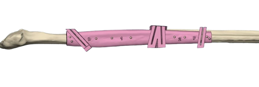 Fibula Cutting Guide