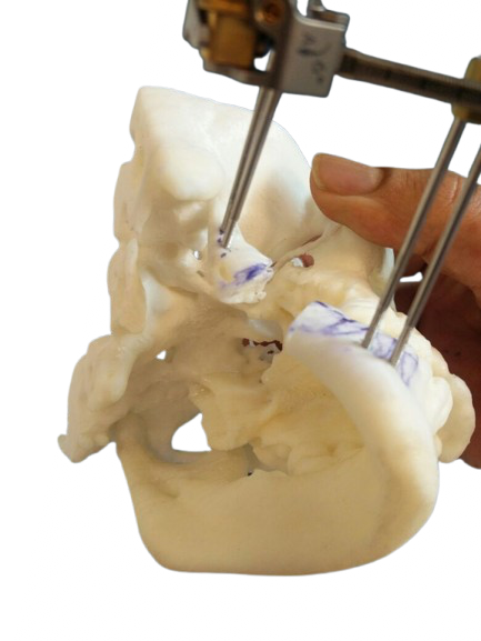 Jaw Model
